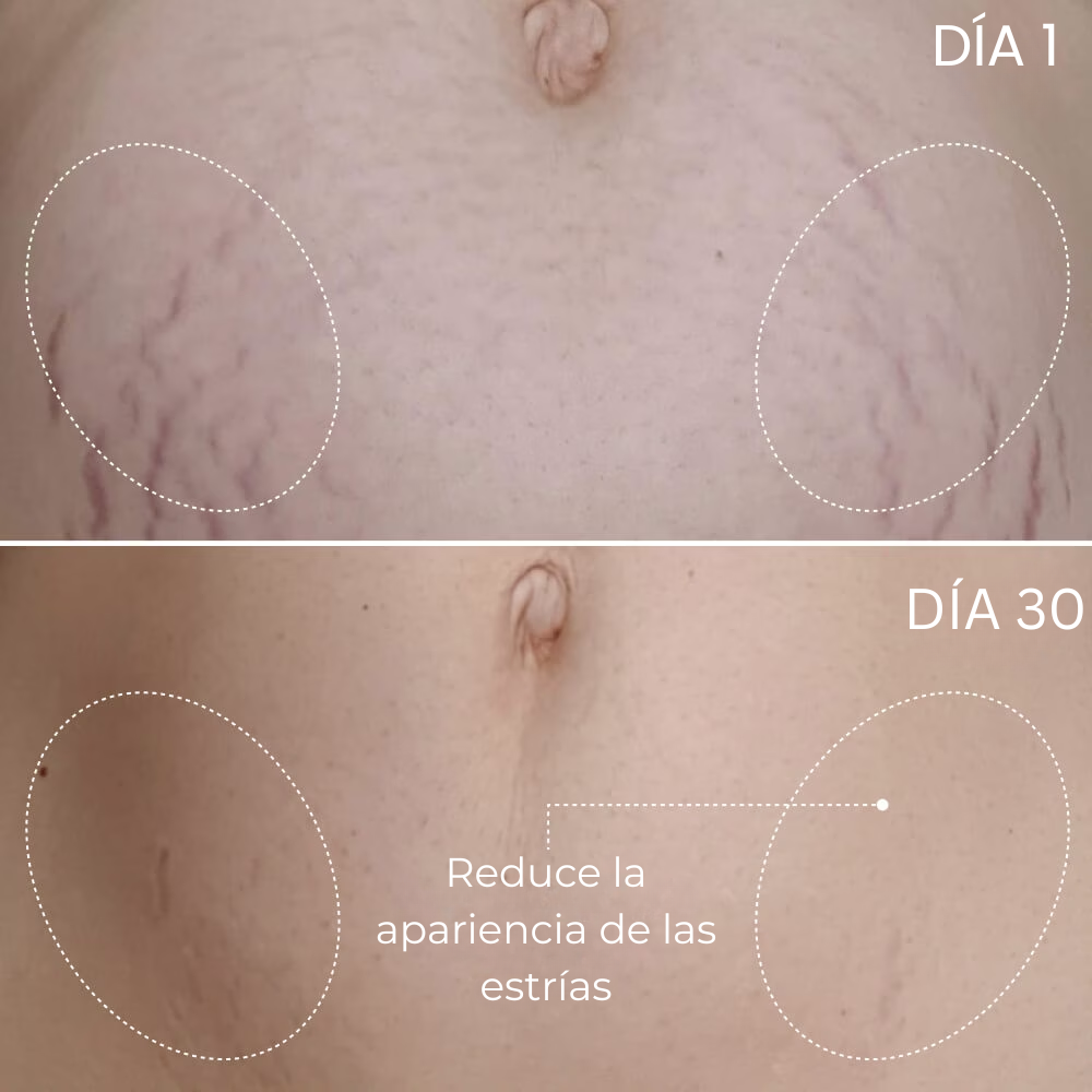 CÚRVERIÁ- Crema Reafirmante